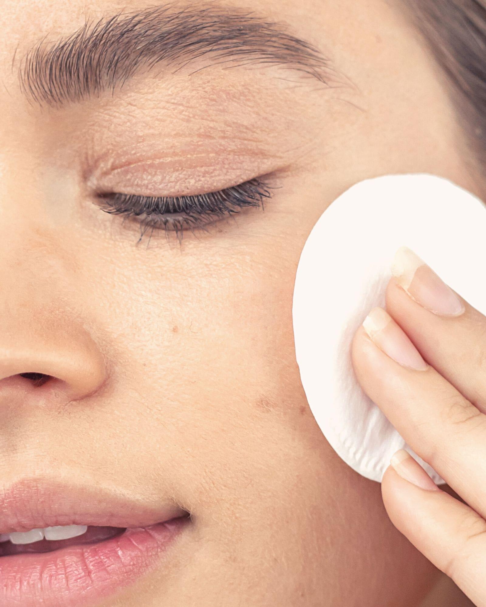 Exfoliating Acne Toner - Salicylic Acid Exfoliating Toner - Glycolic Acid Exfoliating Toner